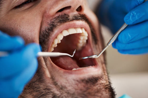 Emergency Dental Services in Venetian Village, IL